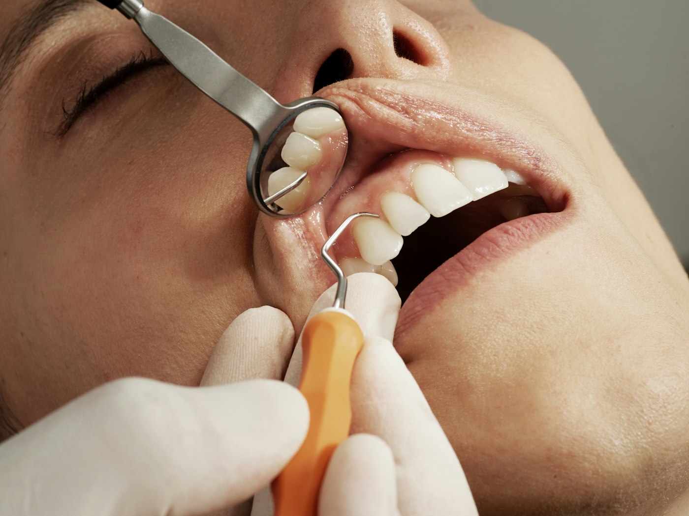 Dental Cleanings