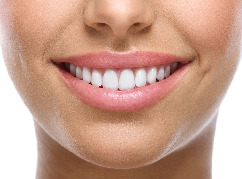 Teeth Whitening Southborough MA