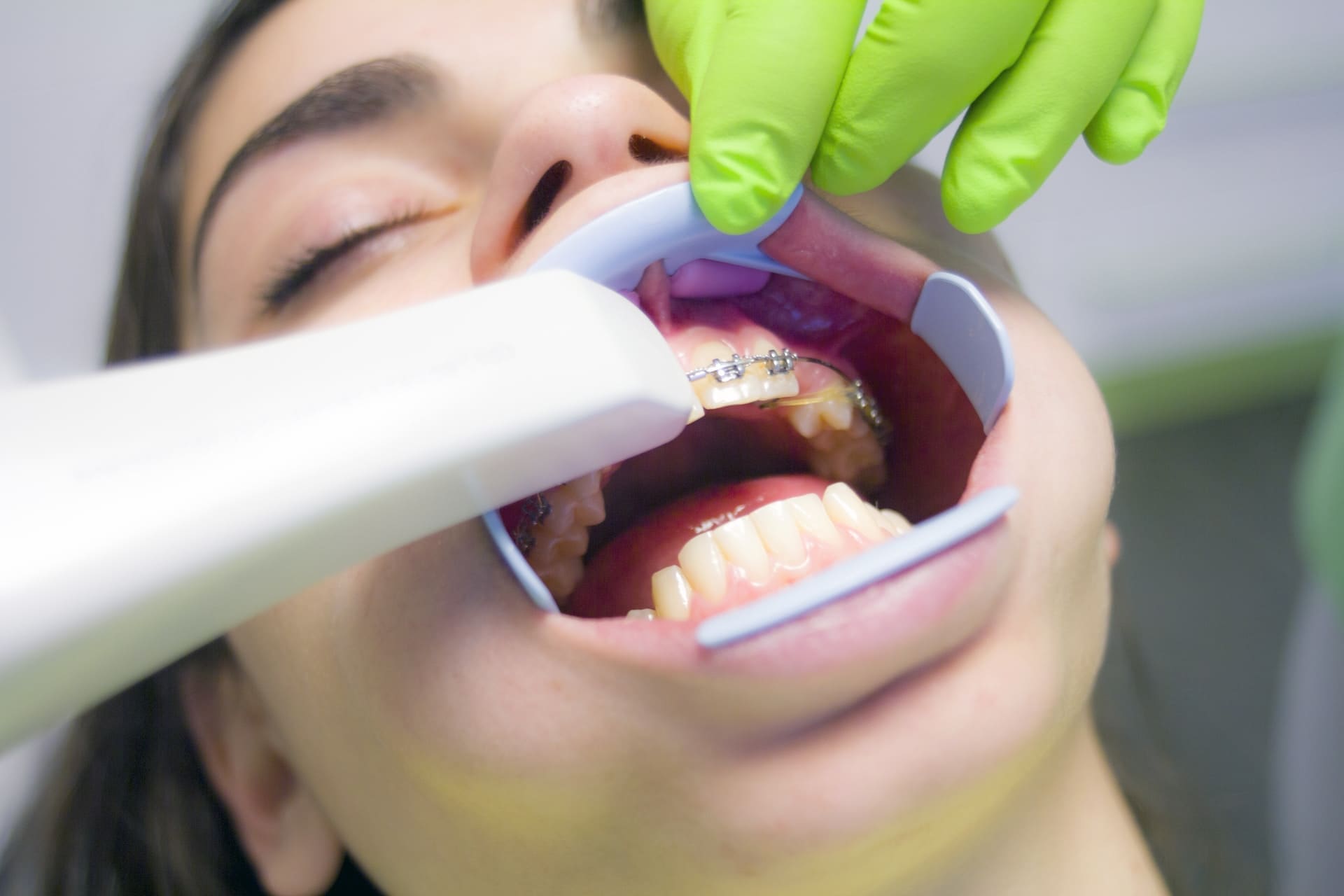 Girl receiving dental treatment for braces