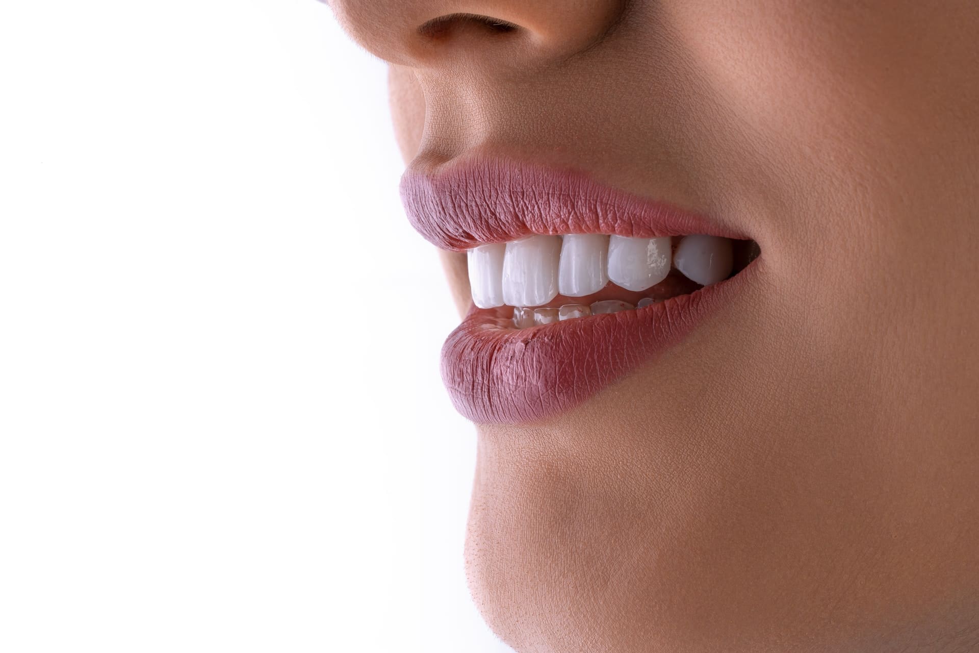 Close-up of a woman showing dental veneer